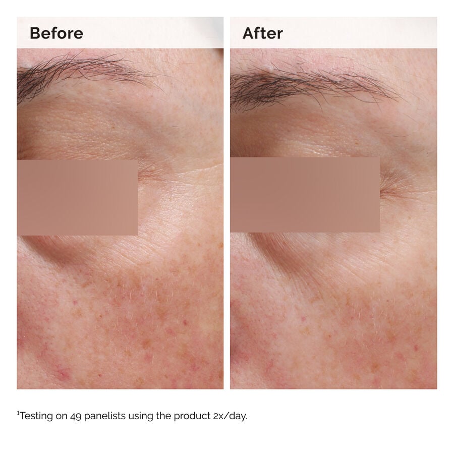 niacinamide-5-face-and-body-emulsion-u8 2024-08-23-ORD-Nia-5pct-Face-Body-B-A-Elasticity-Global-02-1x1.jpg