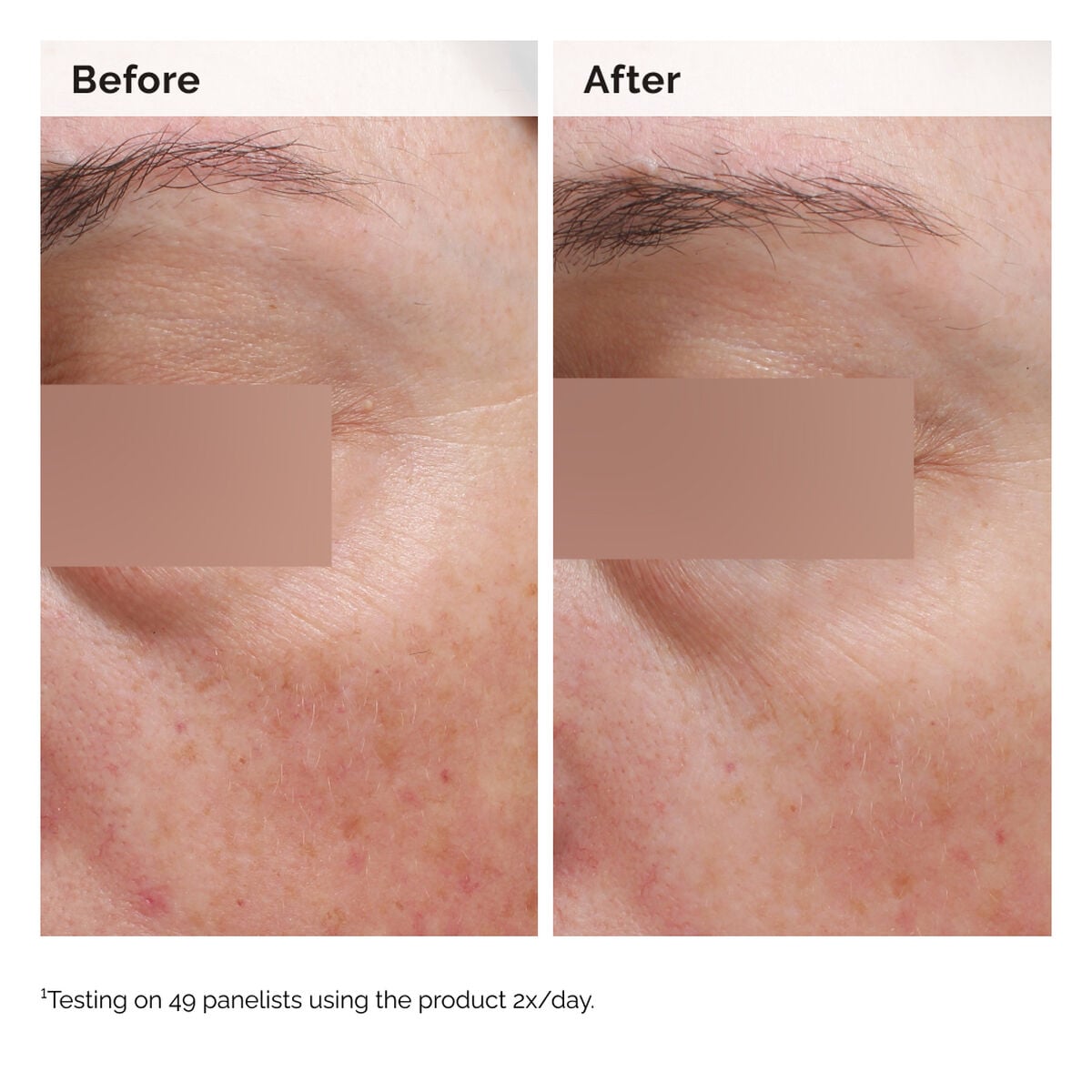 niacinamide-5-face-and-body-emulsion-u8 2024-08-23-ORD-Nia-5pct-Face-Body-B-A-Elasticity-Global-02-1x1.jpg