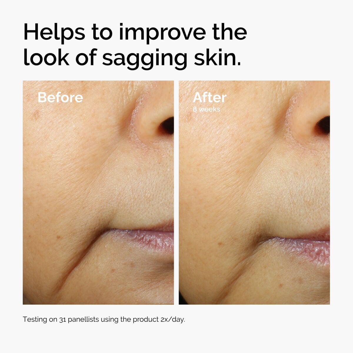 caffeine-3-escin-1-face-serum-y1 ord-caffeine-3pct-escin-1pct-face-serum-before-after-sagging.jpg