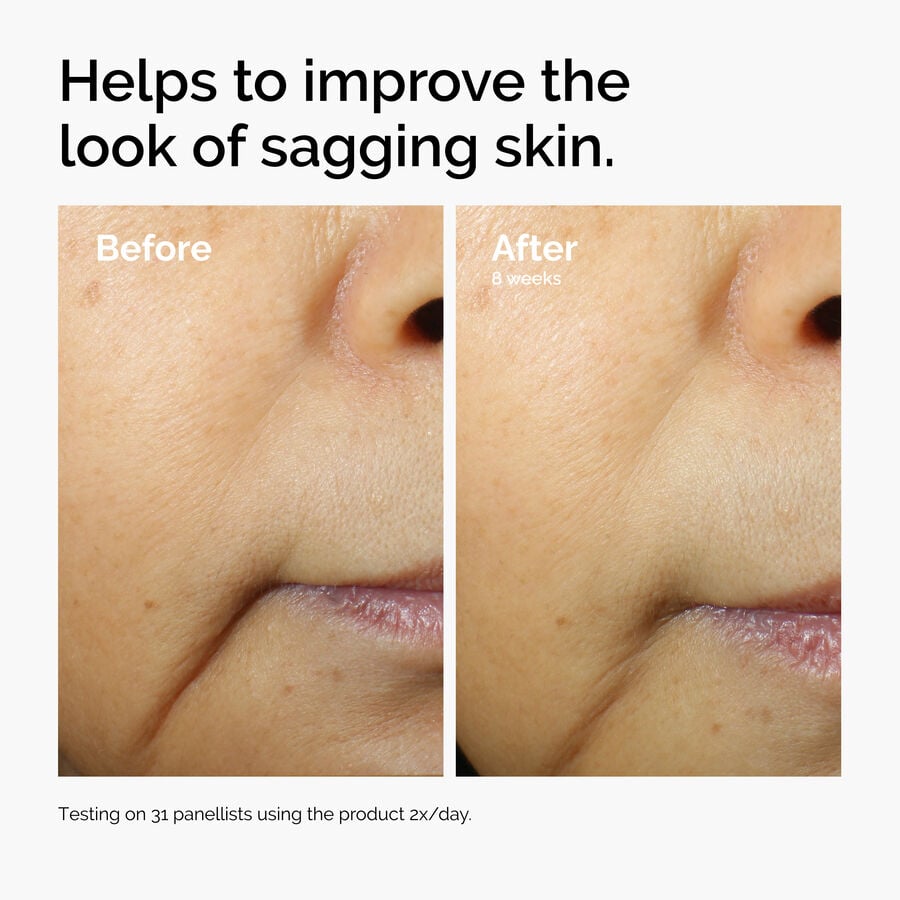 caffeine-3-escin-1-face-serum-y1 ord-caffeine-3pct-escin-1pct-face-serum-before-after-sagging.jpg
