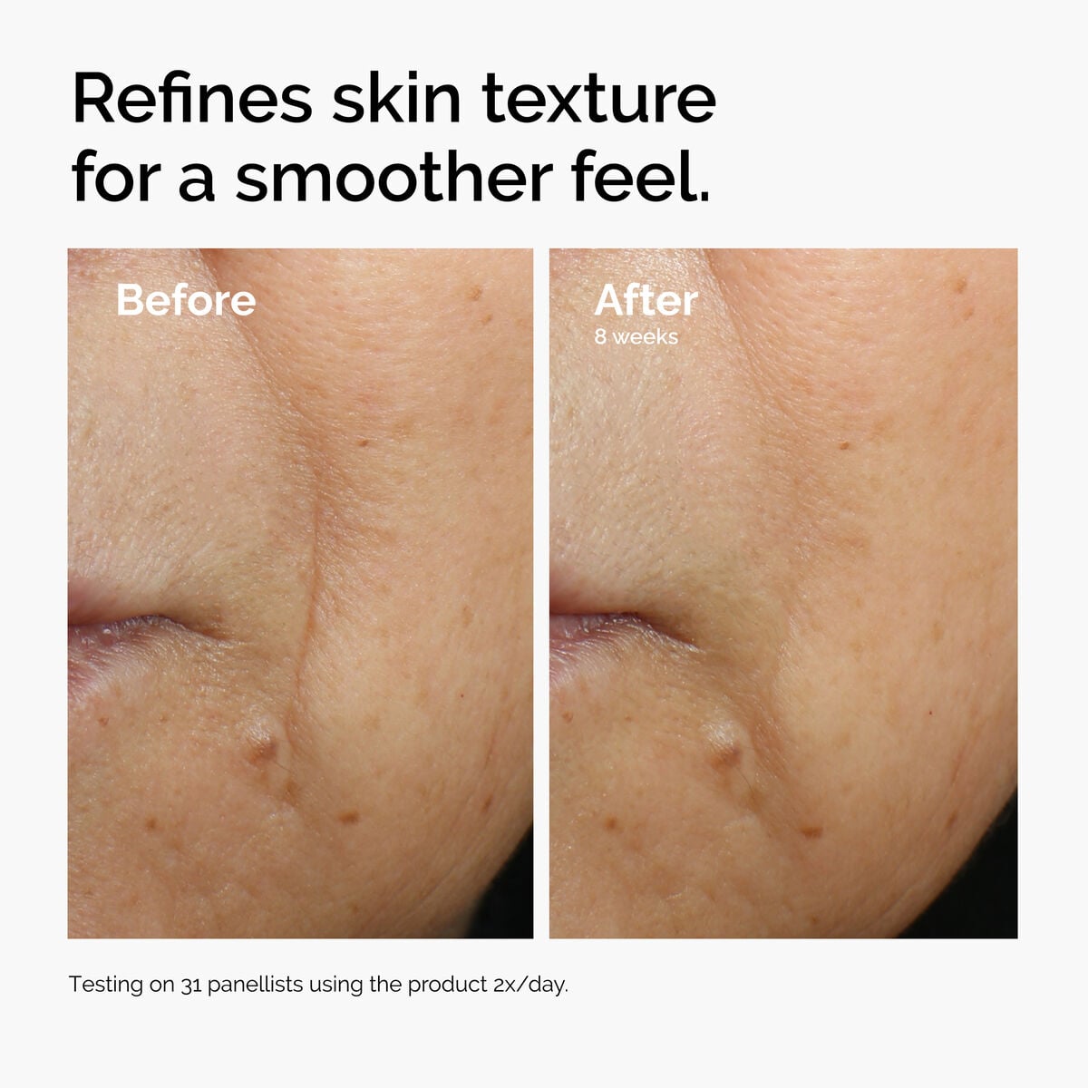 caffeine-3-escin-1-face-serum-y1 ord-caffeine-3pct-escin-1pct-face-serum-before-after-texture.jpg