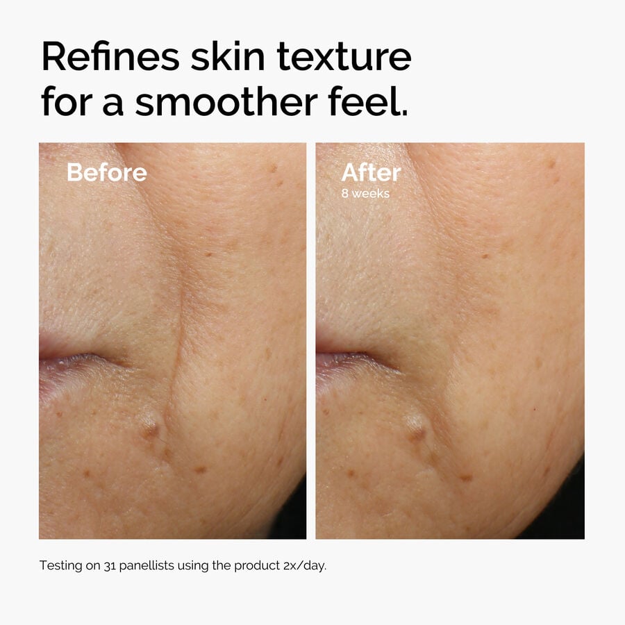 caffeine-3-escin-1-face-serum-y1 ord-caffeine-3pct-escin-1pct-face-serum-before-after-texture.jpg