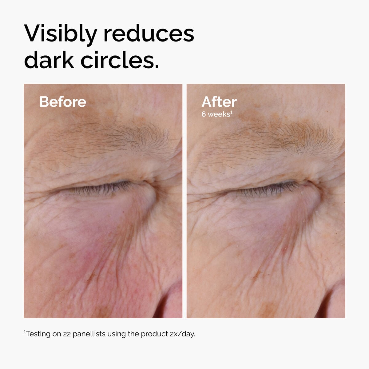 caffeine-solution-5-egcg-eye-serum-r0 ord-caffeine-solution-egcg-dark-circles-before-after.jpg