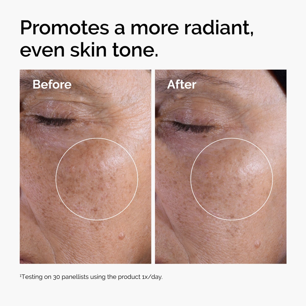 glycolic-acid-7-exfoliating-toner-o3 ord-glycolic-before-after-radiance.jpg