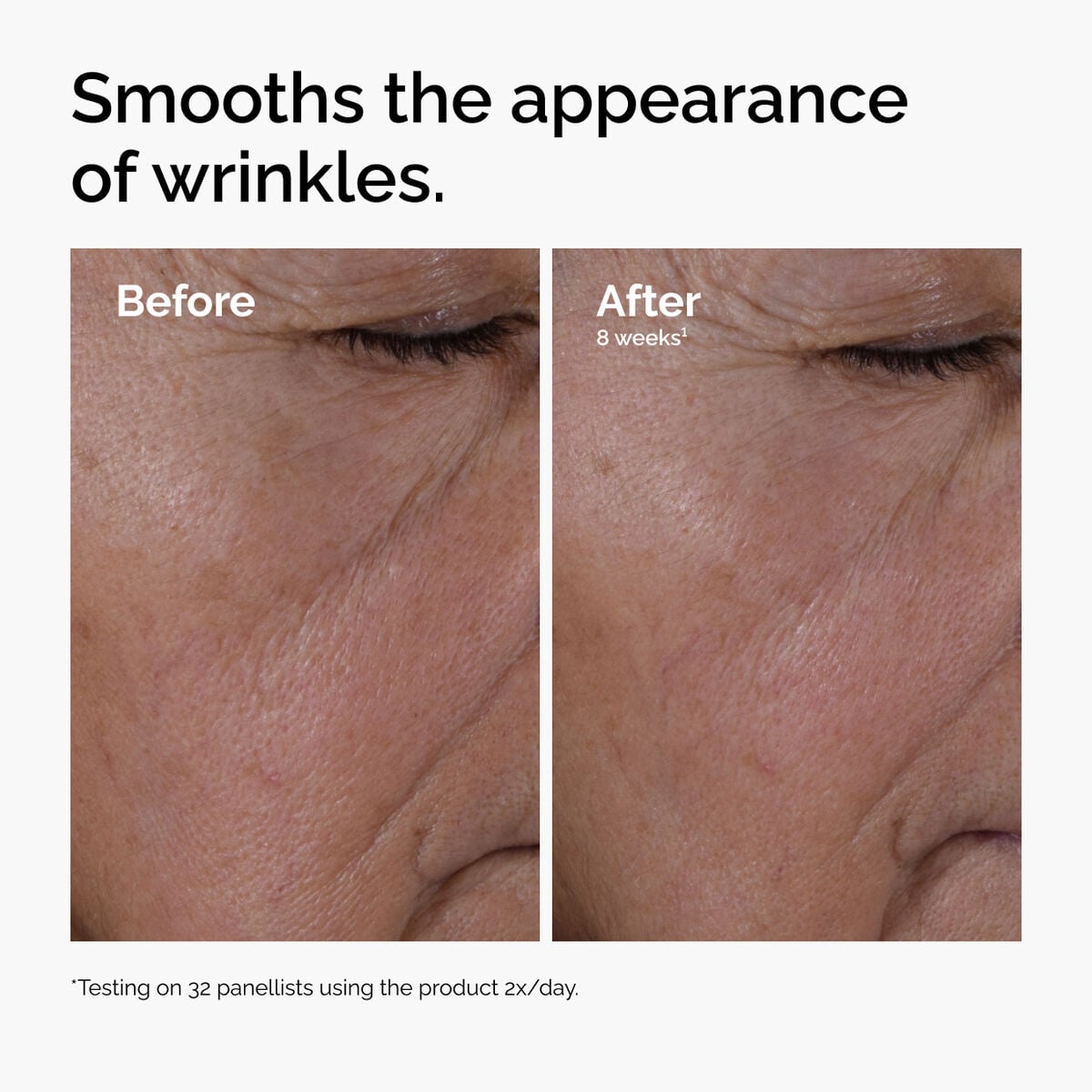 multi-peptide-ha-serum-d9 ord-multi-peptide-ha-serum-wrinkles-before-after.jpg