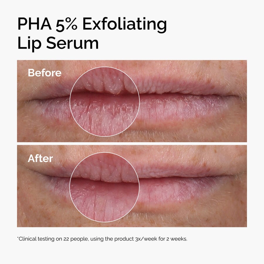 pha-5-exfoliating-lip-serum-q3 ord-pha-5pct-lip-exfoliating-serum-before-after.jpg